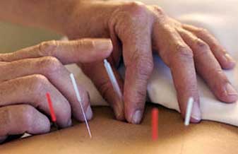 Rodolfo Calado Lopes - Foto 1