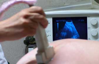 Alcindo Bezerra de Menezes Neto - Foto 1