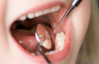 Dental Garanhuns - Foto 1